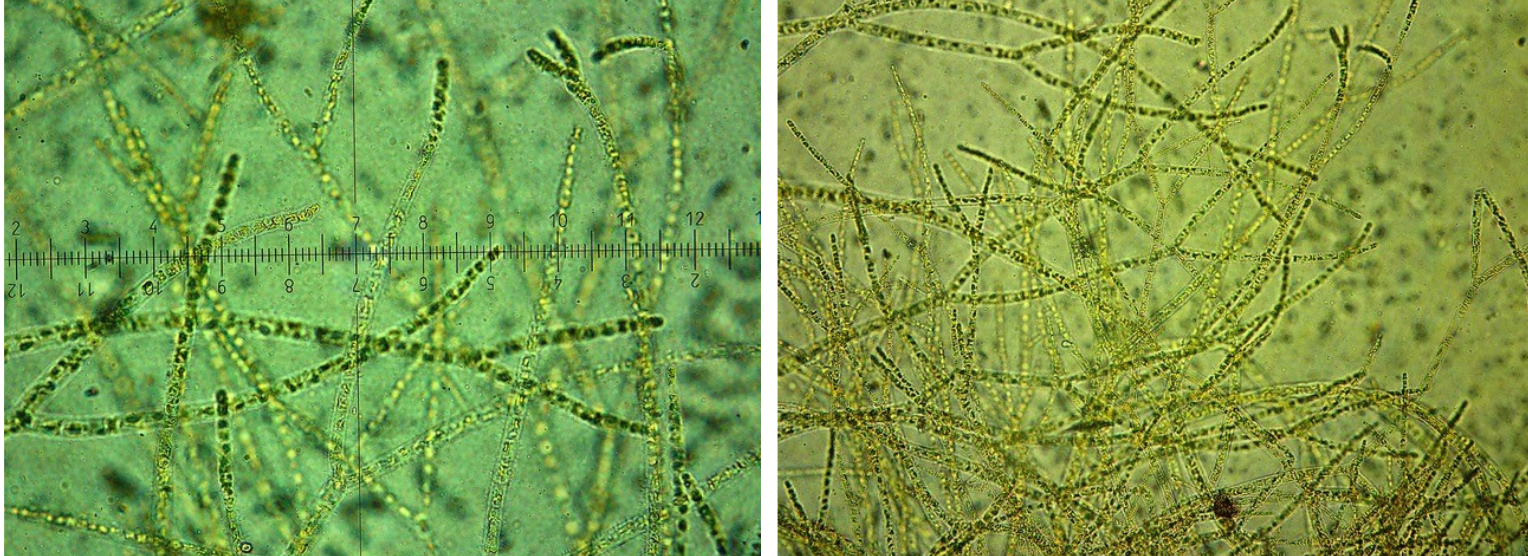 Detall dels filaments de l'alga.